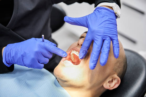 Best Emergency Wisdom Teeth Removal in Maize, KS